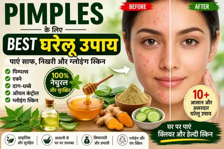 ◆ 7 Din me Pimples Kaise Hataye Naturally | Complete Home Treatment
